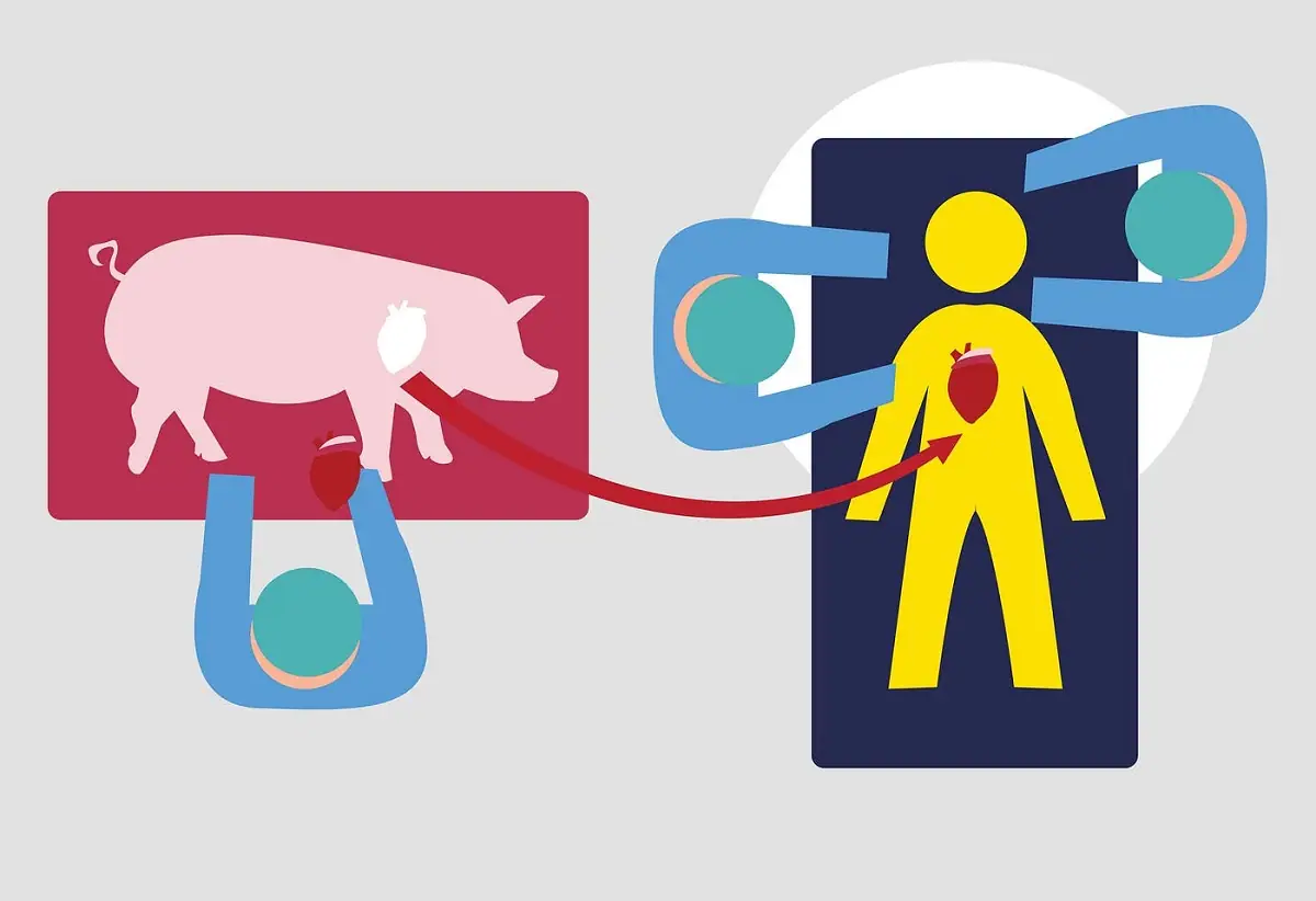 Pig Heart Transplant Successfully Performed in the United States 1 xenotransplantation